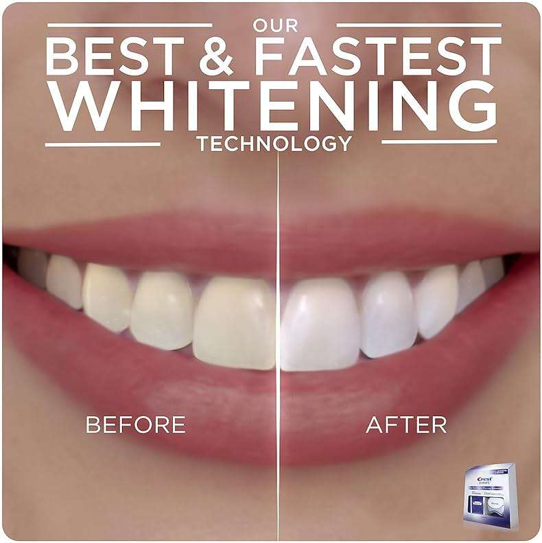 Crest 3D Whitestrips Express Whitening + LED Light – Teeth Whitening Kit, 1 Light + 10 Treatments, Each with 1 Upper/1Lower, 20 Strips – Crest 3DWhite Teeth Whitening Strips - Image 5
