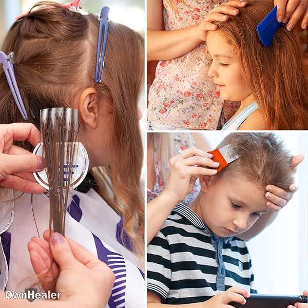 OWNHEALER Professional Lice Comb Kit - for Lice, Nits, and Dandruff Removal. Quick Results for Head Lice Treatment - Suitable for All Hair Types. Peine para piojos y liendres. - Image 7
