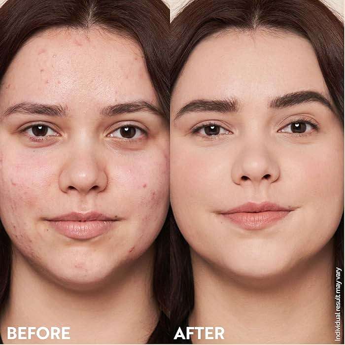 M. Asam Magic Finish Make-Up Mousse (1.01 Fl Oz) – 4in1 Primer, Foundation, Concealer & Powder With Buildable Coverage, Hides Redness And Dark Spots, Vegan, For Light To Medium Skin Tones - Image 7