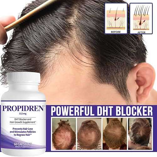 Propidren by HairGenics - DHT Blocker & Hair Growth Supplement with Saw Palmetto & Biotin To Prevent Hair Loss and Stimulate Hair Follicles to Stop Hair Loss and Regrow Hair. - Image 3