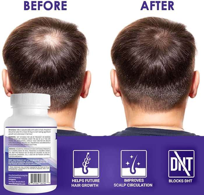 Propidren by HairGenics - DHT Blocker & Hair Growth Supplement with Saw Palmetto & Biotin To Prevent Hair Loss and Stimulate Hair Follicles to Stop Hair Loss and Regrow Hair. - Image 7