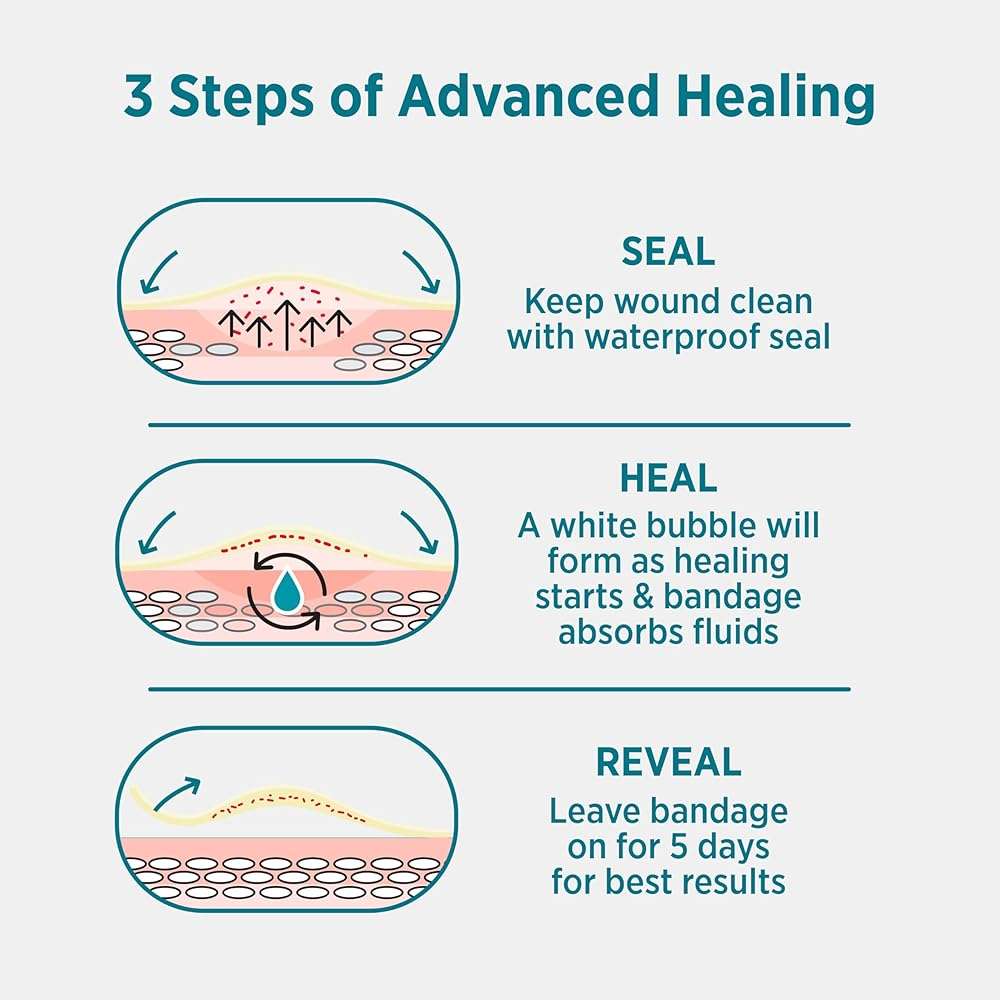 BAND-AID Brand Pro Heal 5 Day Protect, Hydrocolloid 100% Waterproof First Aid Blister Bandages for Advanced Healing, Extra Cushion for Blister Protection & Less Scarring Versus Uncovered Wound, 6 ct - Image 7