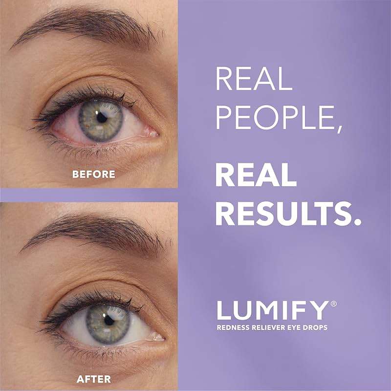 LUMIFY Eye Drops for Red Eyes, Redness Reliever for Brighter Looking Eyes, Works in 1 Minute & Lasts Up to 8 Hours, Eye Drops, 0.08 Fl Oz (2.5 mL) - Image 2