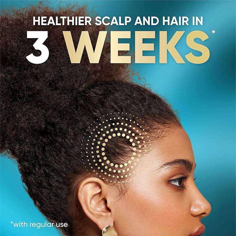 Head & Shoulders Royal Oils Daily Moisture Scalp Cream Treatment, Formulated with 1% Pyrithione Zinc, Anti-Dandruff Scalp Care with Coconut Oil, 5.0 fl oz - Image 4