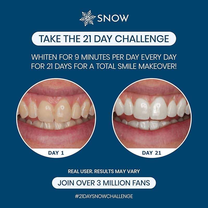 SNOW Diamond Wired Whitening Kit - Sensitive Teeth Whitening Kit - Whitens & Repairs Teeth - 6 Months of Whitening Treatment - Gentle & Enamel Safe - Blue - Image 4
