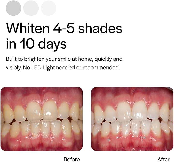 Opalescence Go Teeth Whitening Trays 15% Hydrogen Peroxide (4 Treatments) Prefilled Whitening Trays, Gentle Formula, No LED Light Needed, Dentist Recommended, Mint Flavor - 4648-1 - Image 4