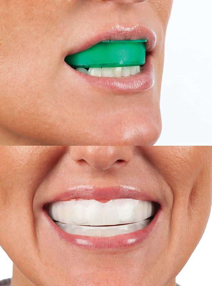 Opalescence Go Teeth Whitening Trays 15% Hydrogen Peroxide (4 Treatments) Prefilled Whitening Trays, Gentle Formula, No LED Light Needed, Dentist Recommended, Mint Flavor - 4648-1 - Image 9