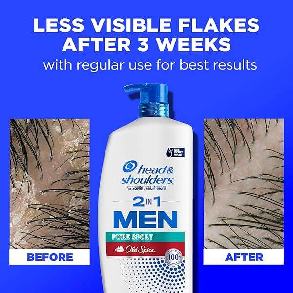 Head & Shoulders 2-in-1 Dandruff Shampoo and Conditioner Set, Clinically Proven Dandruff & Itch Relief, Lemon-Lime Scent of Old Spice Pure Sport, Nourish Scalp & Hair, 31.4 Fl Oz Each, 2 Pack - Image 6