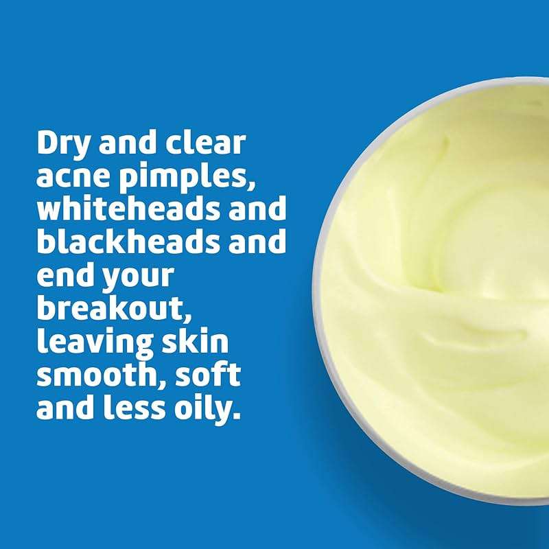 De La Cruz Sulfur Ointment - Cystic Acne Treatment for Face and Body - Daily 10 Min Spot Treatment Mask - Safe and Effective Game Changing Hormonal Acne Treatment that Clears Up Pimples 5.5 OZ. - Image 4