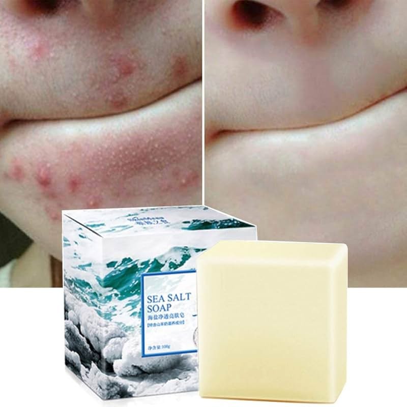 Soap with Sea Salt Natural Goat's Milk for Face Dry and Natural Oily Skin, Remove Acne Anti-cellulite Soap (3.52 Oz) - Product Image