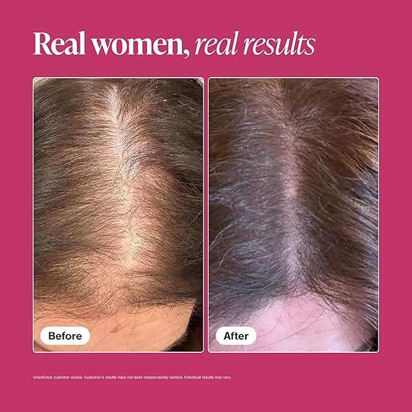 Viviscal Hair Growth Supplements For Women For Thicker, Fuller Hair, Nourishes Thinning & Loss, With Proprietary Collagen Complex, 60 Tablets, 1 Month Supply - Image 5