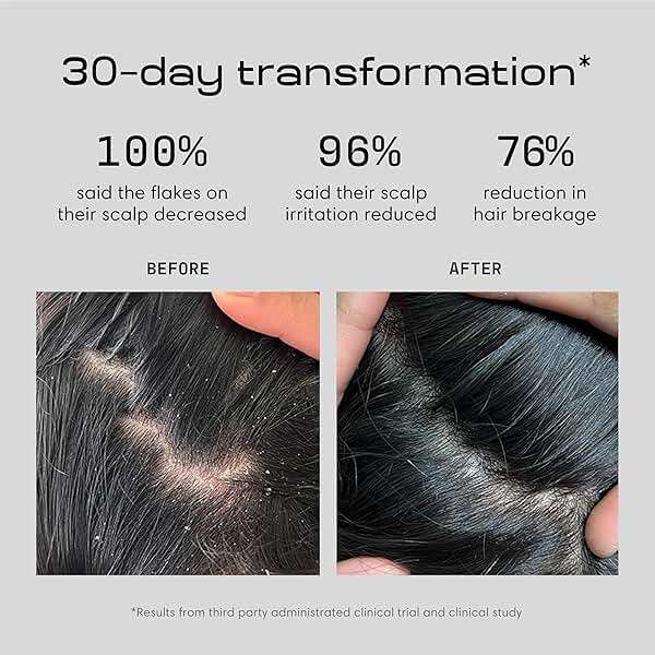 Jupiter Anti Dandruff Shampoo - Shampoo for Men & Women for Flaky, Itchy, Oily, & Dry Scalp - Nourishes Scalp and Reduces Breakage & Flakes - Color-Safe, Sulfate-Free, Paraben-Free - Image 2