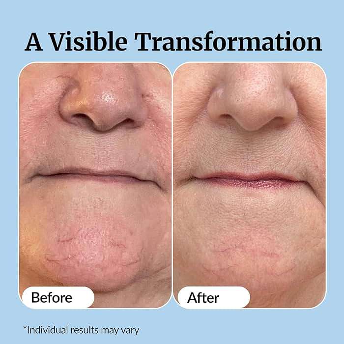 Vibriance Super C Serum for Mature Skin - All-in-One Vitamin Formula Hydrates, Firms, Lifts, Smooths, Targets Age Spots, Wrinkles, 1 fl oz - Image 5