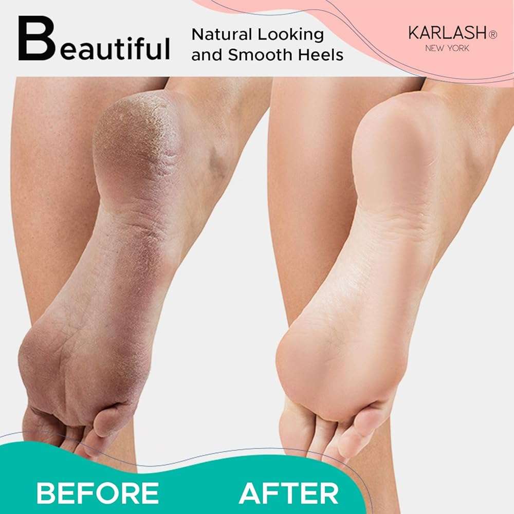 Karlash Professional Pedicure Foot Pumice Stone for Feet Skin Callus Remover and Scrubber for Dead Skins 2 Sided (Pack of 1) - Image 3