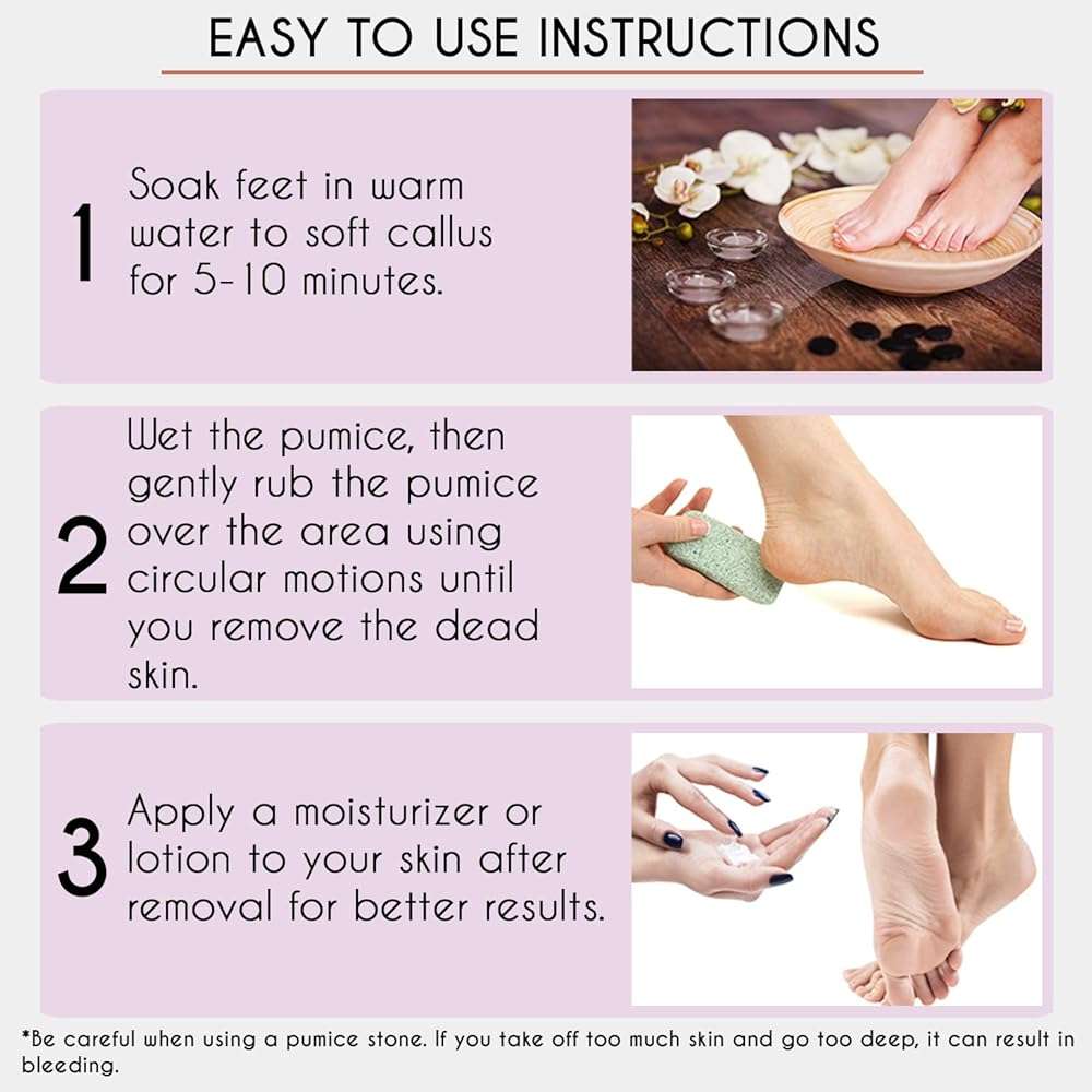 Karlash Professional Pedicure Foot Pumice Stone for Feet Skin Callus Remover and Scrubber for Dead Skins 2 Sided (Pack of 1) - Image 4