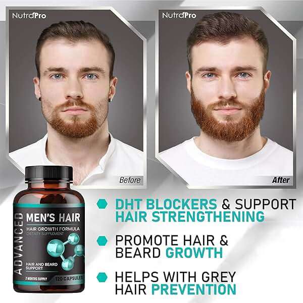Hair Growth Vitamins For Men - Anti Hair Loss Pills. Regrow Hair & Beard Growth Supplement For Volumize, Thicker Hair.Stop Hair Loss And Thinning Hair With Biotin & Saw Palmetto Hair Vitamins.120 Caps - Image 3
