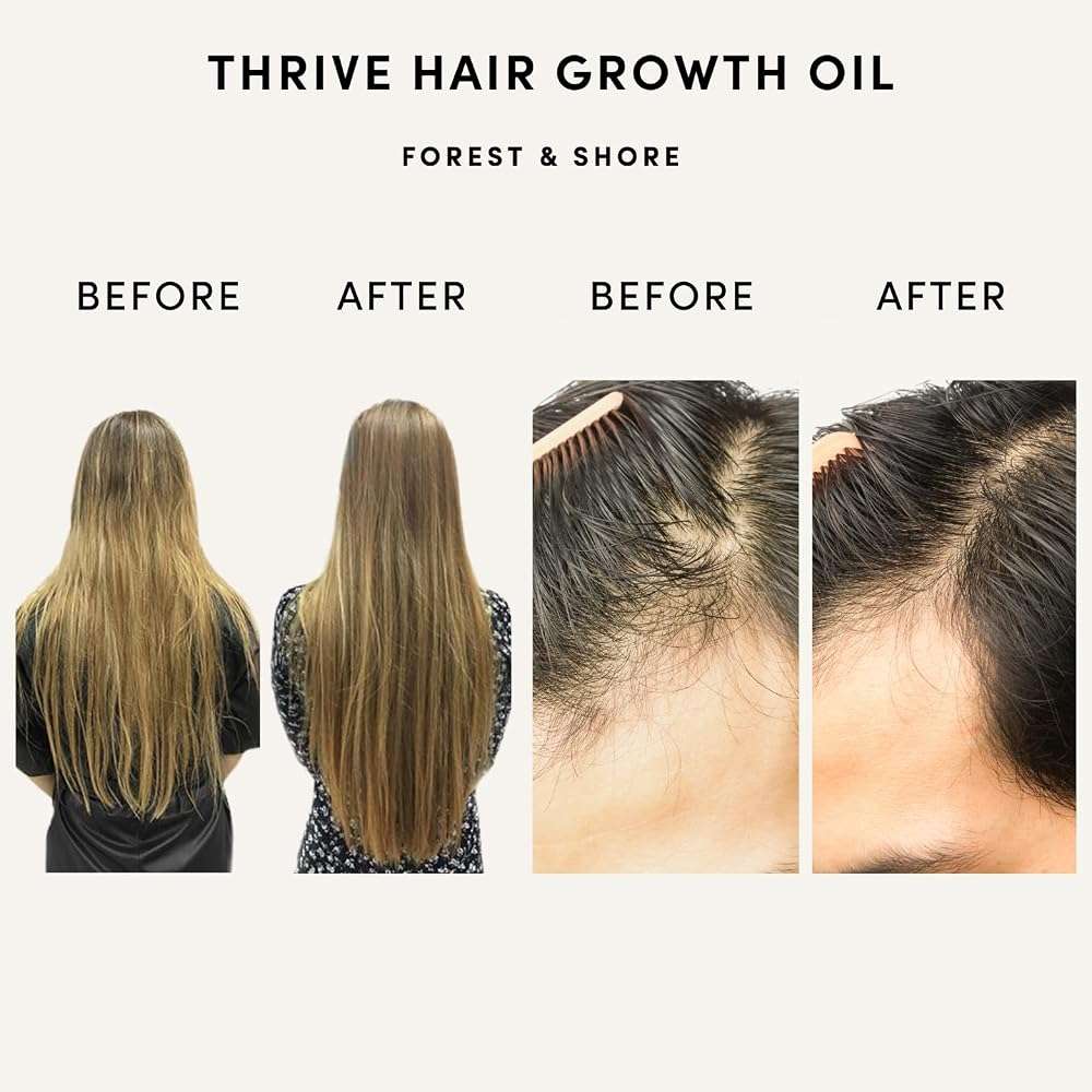 Forest & Shore Hair Growth Oil & Serum - Visibly Fuller, Thicker, Stronger Hair with Caffeine, Biotin & 13 Natural Oils - Rosemary, Castor & Argan Scalp Treatment for Women & Men - Vegan - Image 2