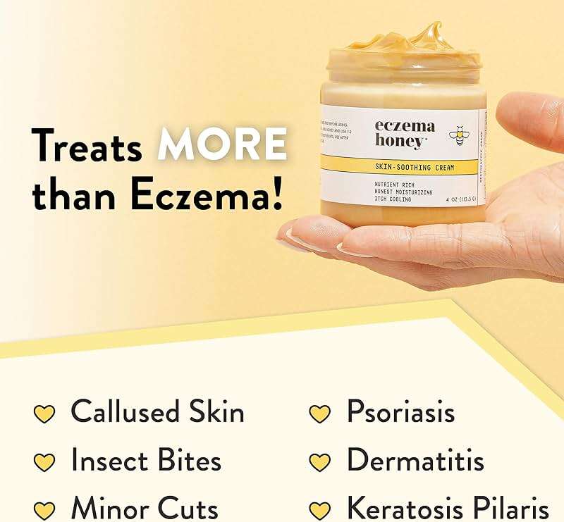 ECZEMA HONEY Original Skin-Soothing Cream - Organic Hand & Body Eczema Relief - Natural Honey Lotion for Dry, Itchy, & Irritable Skin (4 Oz) - Image 5