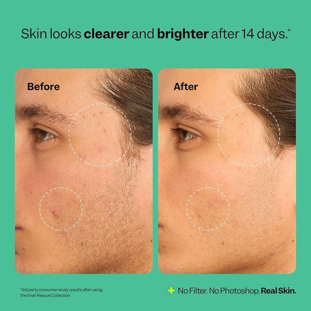 Peach Slices - Snail Rescue Blemish Busting Toner (4.05 oz) - 95% Snail Mucin Concentrate - Clarify, Strengthen, Balance - Hyaluronic Acid & CICA - Clean & Cruelty Free - Korean Skin Care & Beauty - Image 6