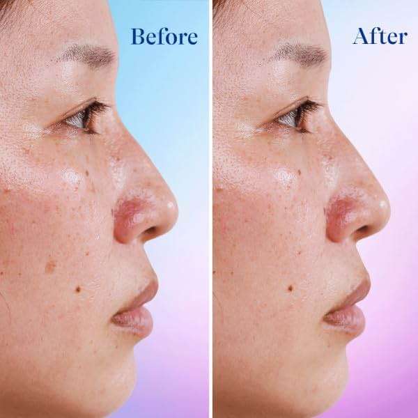 Differin Dark Spot Correcting Face Serum, Dark Spot Correcting Serum by the makers of Differin Gel, Gentle Skin Care for Acne Prone Sensitive Skin, 1 oz (Packaging May Vary) - Image 6