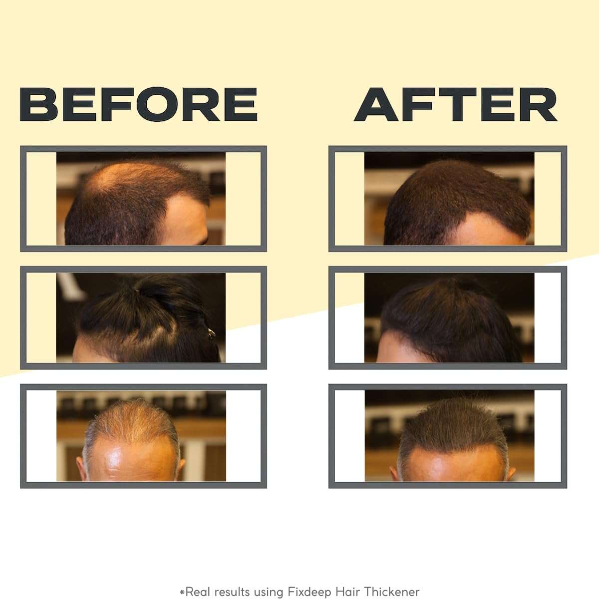 Fixdeep Hair Fibers for Thinning Hair | Waterproof & Sweat-Resistant - Instantly Fuller Hair in 30 Seconds - 14g - Covers Bald Spots & Gray Roots (Black) - Image 2