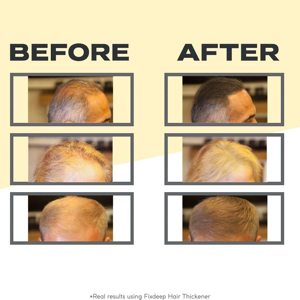 Fixdeep Hair Fibers for Thinning Hair | Waterproof & Sweat-Resistant - Instantly Fuller Hair in 30 Seconds - 14g - Covers Bald Spots & Gray Roots (Black) - Image 3
