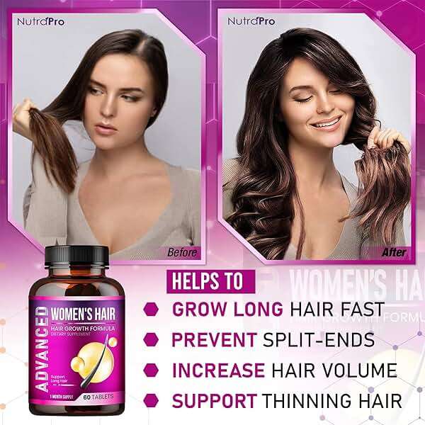 Hair Growth Vitamins for Women - Hair Vitamins for Thinning Hair for Women .Regrow & Regrowth Hair Supplement with Dht Blocker,Biotin & Saw Palmetto for Women.Volumize,Thicker,Longer Hair. - Image 3