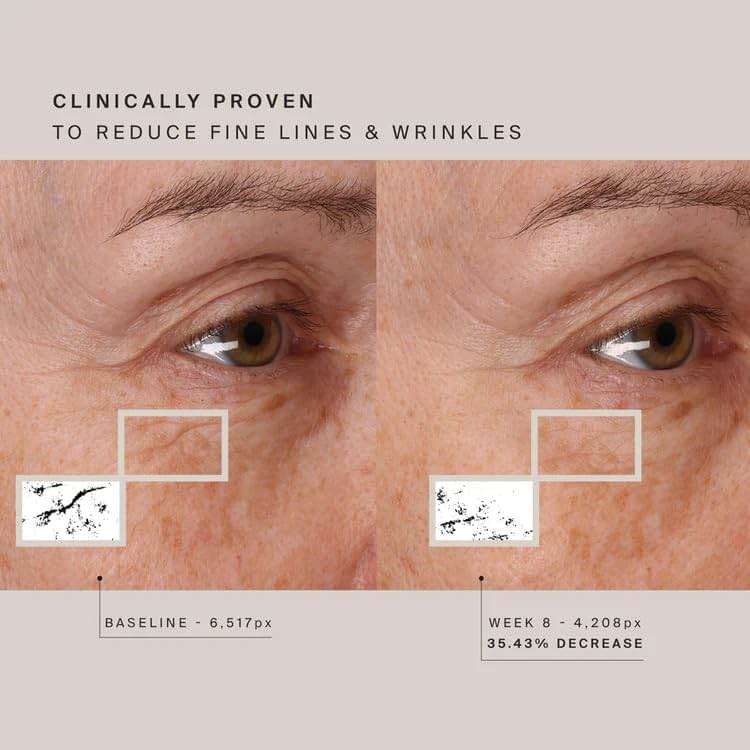 HigherDOSE Red Light Face Mask - FDA Cleared LED Red Light Therapy for Face with Near Infrared Technology - At-Home Facial Device to Improve Fine Lines, Wrinkles, Hydration & Redness for Glass Skin - Image 5