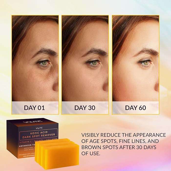 VALITIC Kojic Acid Dark Spot Remover Soap Bars with Vitamin C, Retinol, Collagen, Turmeric - Original Japanese Complex Infused with Hyaluronic Acid, Vitamin E, Shea Butter, Castile Olive Oil (3 Pack) - Image 2