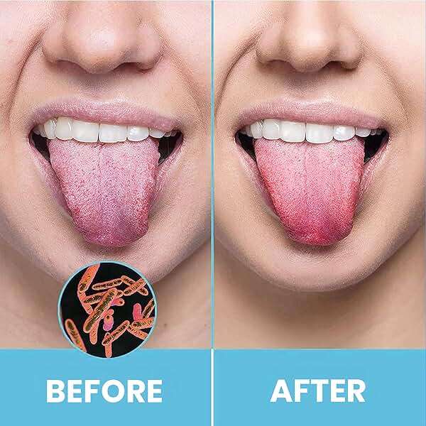 Tongue Scraper for Adults by HOKIN (2Pcs Oral Care Pack) Stainless Steel Tongue Cleaners Reduce Bad Breath 100% Metal Tough Scrapers Men and Women Hygiene Product - Image 2