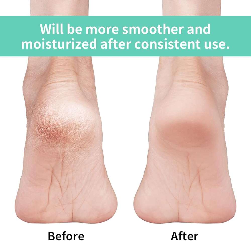 Vaincre Gel Moisturizing Heel Socks for Dry Cracked Feet Women, 4 Pairs Foot Care Spa Moisture Toeless Socks for Cracked Heel Repair Treatment Overnight (Regular) - Image 2