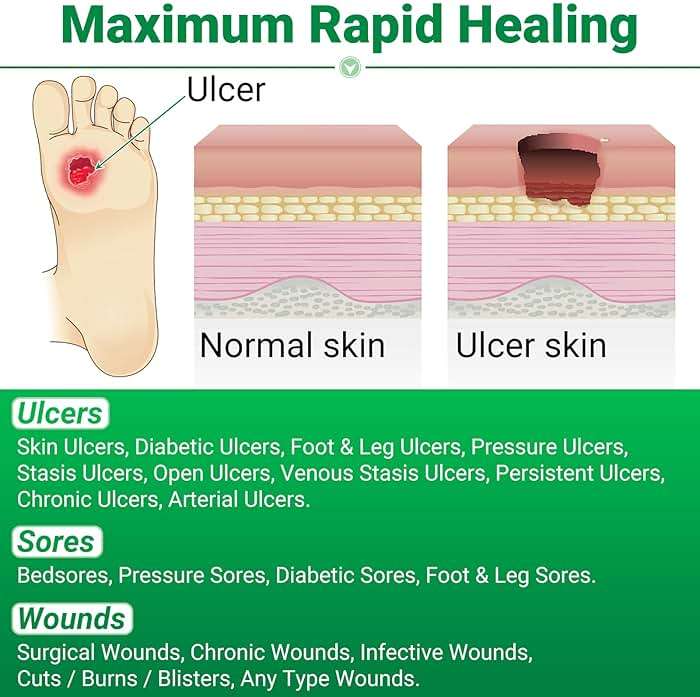 LMNOOP® Skin Ulcer Healing Ointment, for Foot & Leg Ulcers, Sores, Varicose Ulcers, Stasis Ulcers, Bedsores, Cuts, Burns, Skin Infections, Natural Ingredients Deep Wound Healing Ointment - Image 2