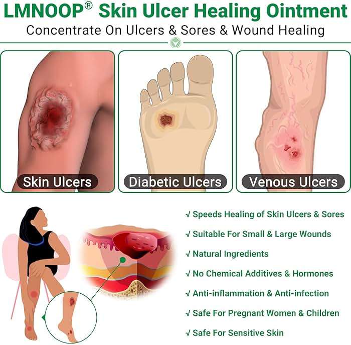 LMNOOP® Skin Ulcer Healing Ointment, for Foot & Leg Ulcers, Sores, Varicose Ulcers, Stasis Ulcers, Bedsores, Cuts, Burns, Skin Infections, Natural Ingredients Deep Wound Healing Ointment - Image 3