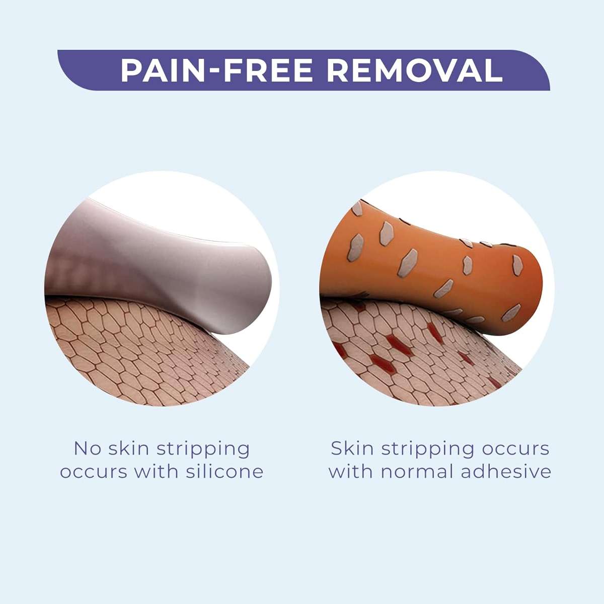 Conkote Pain-Free Removal Silicone Tape 1" x 5 Yards, Strong Adhesion and Hypoallergenic, Good for Sensitive Skin, 2 Rolls - Image 4