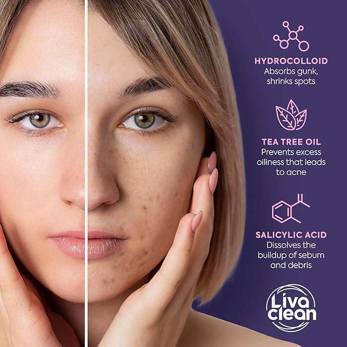 Livaclean 240CT Star Pimple Patches for Face w/ Hydrocolloid, Tea Tree oil & Salicylic Acid - Zit Stickers, Hydrocolloid Acne Patches for Face - Cute Pimple Patch, Acne Stickers - Image 6