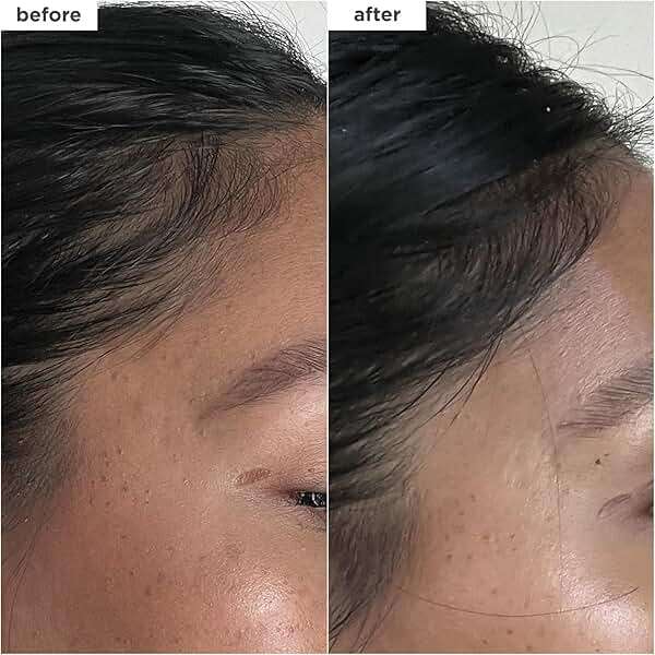 Briogeo Destined for Density Caffeine + Biotin Peptide Density Serum | Increases Hair Thickness & Volume for Fine or Thinning Hair | Fast-Absorbing & Non-Greasy | Fragrance-Free | Vegan & Cruelty-Free - Image 4