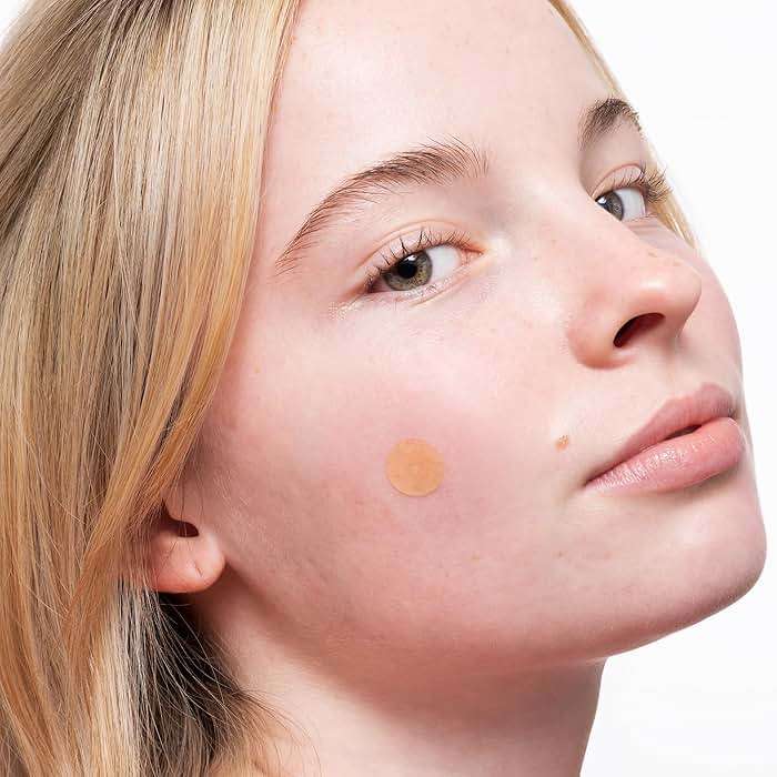 PEACE OUT Acne Healing Dots Hydrocolloid Pimple Patches, Acne Spot Treatment with Salicylic Acid, Retinol, and Aloe Vera for Blemishes and Breakouts (40 count) - Image 8
