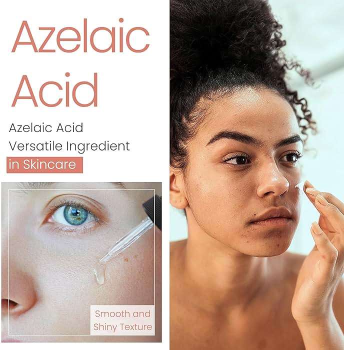 Azelaic Acid Powder (2 Oz / 56 Gram) 99.9% Azelaic Acid Fine Powder for Making DIY Azelaic Acid Cream, Gel and Azelaic Acid Serum by Talsen Chemicals - Image 7