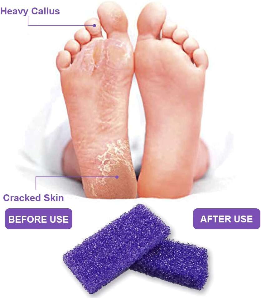 BPrettier Foot Pumice Stone Pumice Stone for Feet Foot Scrubber Sponge Callus Remover Dead Skin,Pedicure Supplies Nail Salon Home Use 40 PCS - Image 6