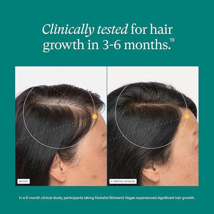 Nutrafol Women's Hair Growth Supplements, for Women 18-44 Years Old, Clinically Tested for Visibly Thicker, Stronger Hair, 100% Vegan Ingredients, Dermatologist Recommended - 2 Month Supply - Image 4