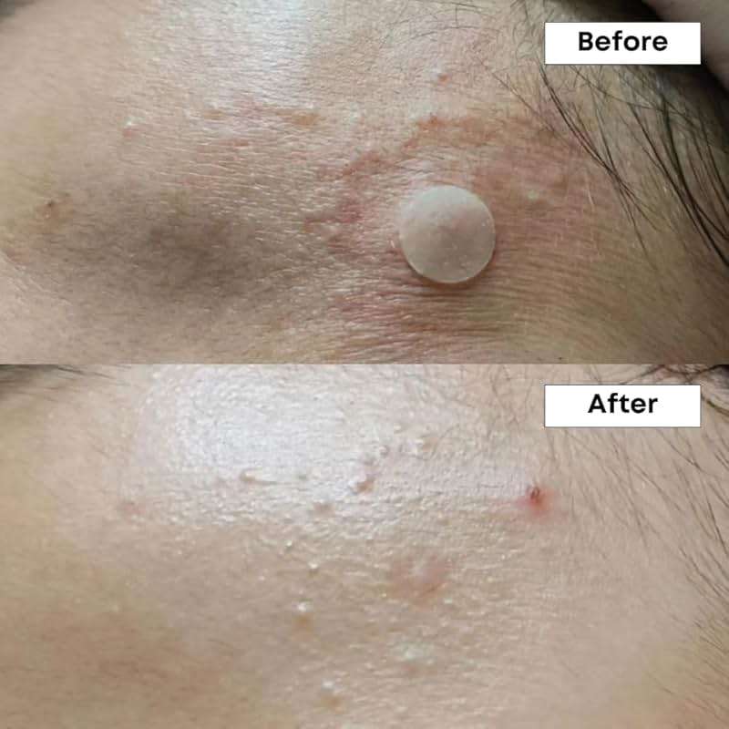 NINELESS A-Control 10% Azelaic Acid Serum - Image 4