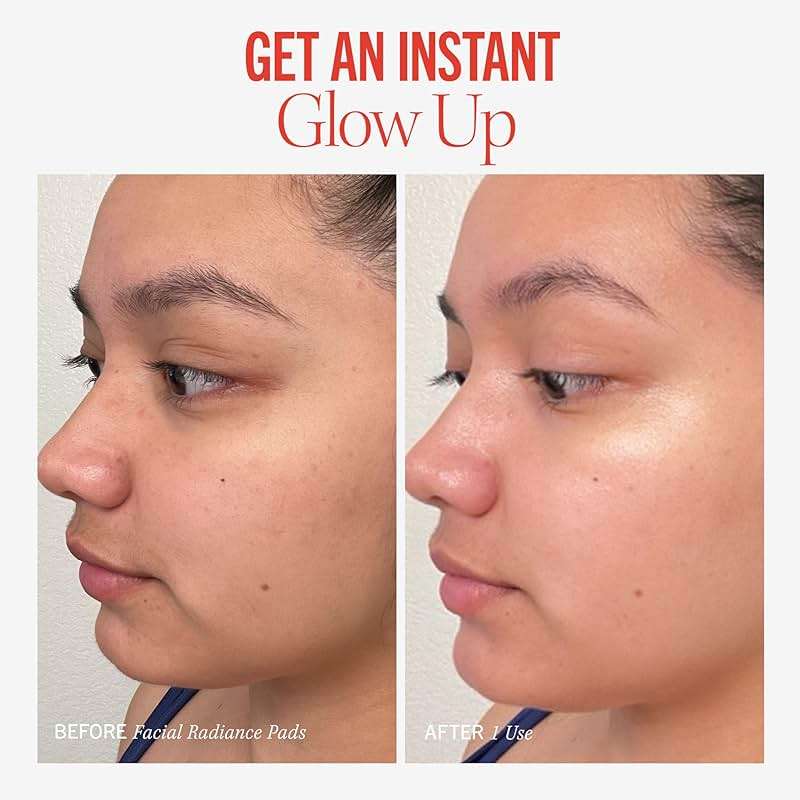 First Aid Beauty - Facial Radiance Pads with Glycolic & Lactic Acids, Daily Exfoliating Pads with AHA, Visibly Smaller Pores, Help Tone & Brighten Skin, One-Step Makeup Prep, Compostable, 28 - Image 5