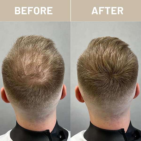 VOLLUCK Hair Fibers for Thinning Hair, Instant Coverage Hair Building Fibers for Women and men, Natural Hair Powder for Conceal Hair Loss 28 g (Dark Brown) - Image 6