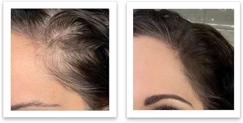 Caboki Root Touch Up Powder: Fill in Thinning Hair, Hairline & Edges, Cover Bald Spots & Gray Hair - TALC-Free, Volumizing Hair Fiber for Men & Women in Salt & Pepper and Dark Shades - Image 3