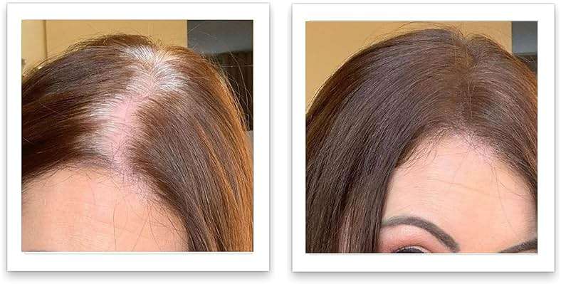 Caboki Root Touch Up Powder: Fill in Thinning Hair, Hairline & Edges, Cover Bald Spots & Gray Hair - TALC-Free, Volumizing Hair Fiber for Men & Women in Salt & Pepper and Dark Shades - Image 5
