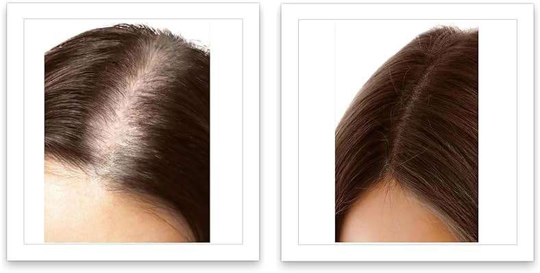 Caboki Root Touch Up Powder: Fill in Thinning Hair, Hairline & Edges, Cover Bald Spots & Gray Hair - TALC-Free, Volumizing Hair Fiber for Men & Women in Salt & Pepper and Dark Shades - Image 8