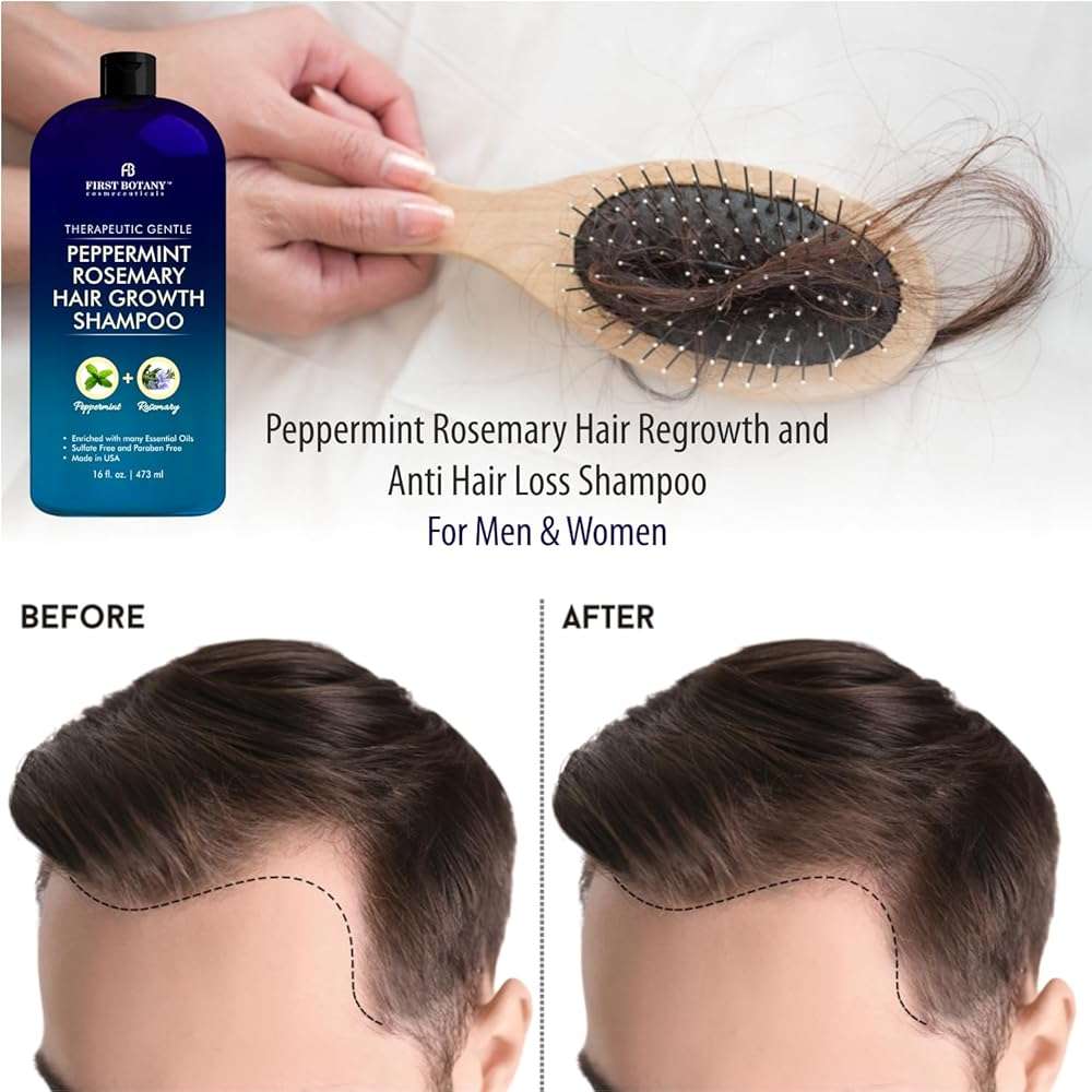 Peppermint Rosemary Hair Regrowth Shampoo - Anti Hair Loss product, Daily Hydrating, Detoxifying, Volumizing Shampoo and Fights Dandruff For Men and Women 16 fl oz - Image 6