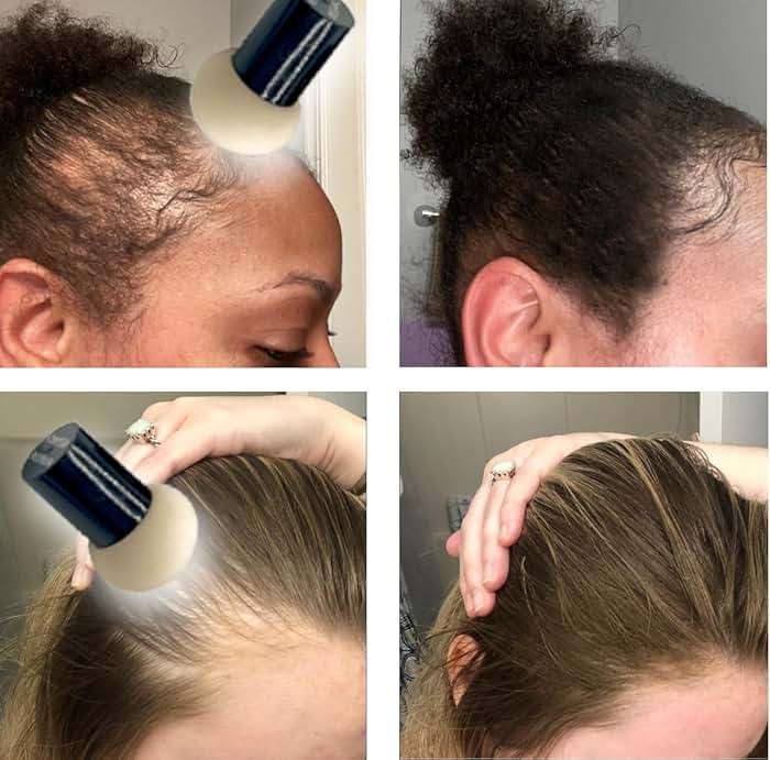 KERATIN RESEARCH Hairline Filler Unisex Mineral Powder Root Touch-Up Hair loss Concealer Scalp & Beard Bald Patch Coverage Fibers for Thinning Hair Waterproof Organic Natural look (AUBURN, XL) - Image 4
