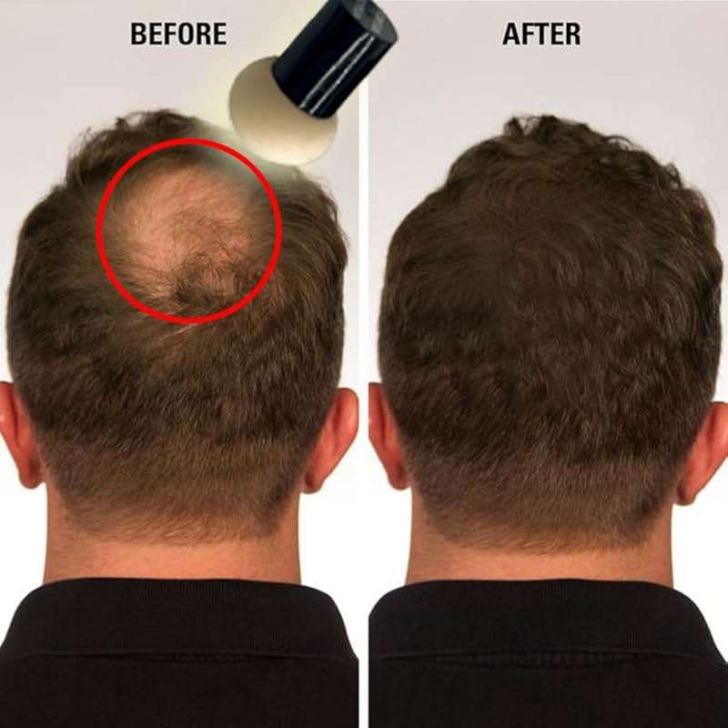 KERATIN RESEARCH Hairline Filler Unisex Mineral Powder Root Touch-Up Hair loss Concealer Scalp & Beard Bald Patch Coverage Fibers for Thinning Hair Waterproof Organic Natural look (AUBURN, XL) - Image 7