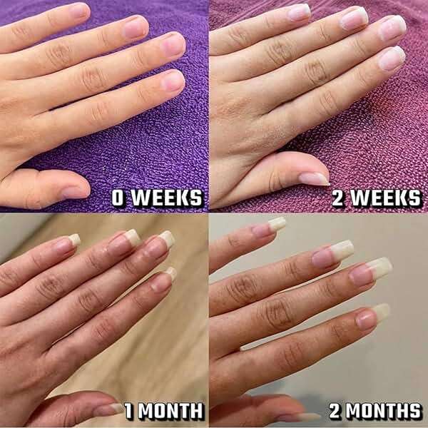 Radiant Nail Growth Oil, Nail Strengthener, Cuticle Oil for Nails, For Moisturize Strengthen Nail Care Oil, Finger Edge Manicure Nourishing Pen, Anti-hangbnail removal, Nail Skin Edge Care - Image 7